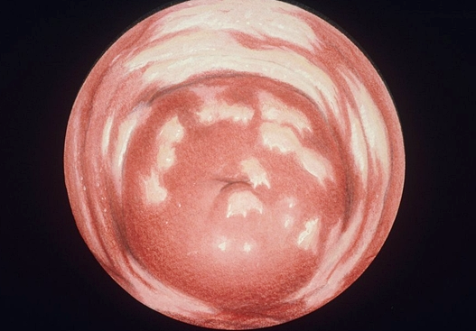 HPV 양성 판정, 포토레이저 치료만큼 중요한 관리는 무엇일까? 관련 해부 구조 그림