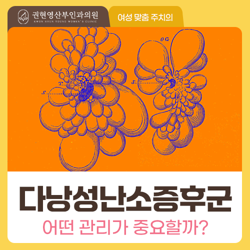 생리가 4개월 넘게 없다면? 다낭성난소증후군 의심 증상과 관리법
